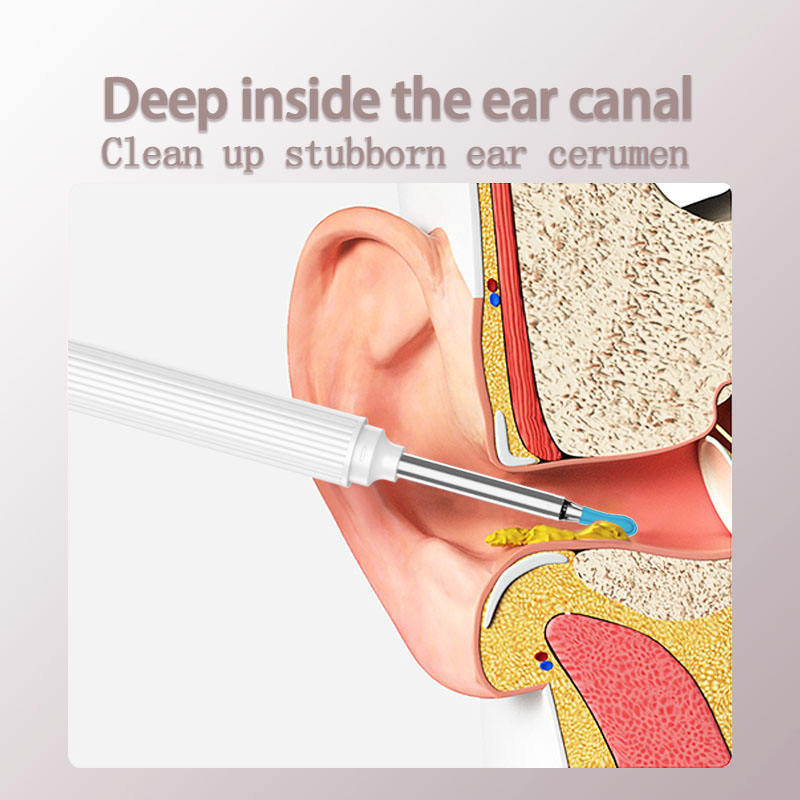 Smart Ear Cleaner Kit